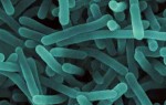 Listeria Workshop to Tackle Prevention, Detection and Mitigation