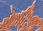 Fast-Growing Salmonella Outbreak Spans 29 States, Origin Still Unknown